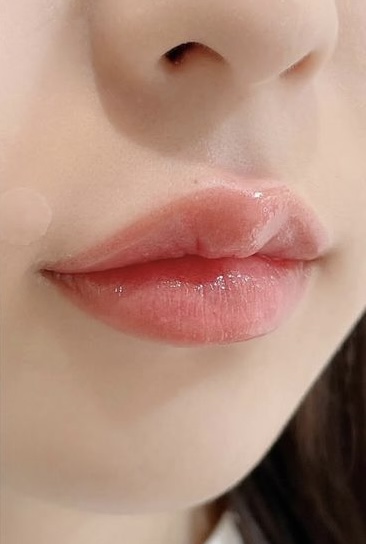 Kết quả môi